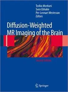 Diffusion-Weighted MR Imaging of the Brain Ed 2