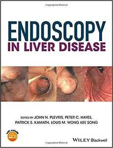 Endoscopy in Liver Disease