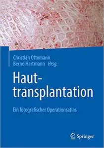 Hauttransplantation: Ein fotografischer Operationsatlas