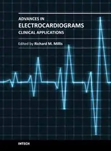 Advances in Electrocardiograms – Clinical Applications by Richard M. Millis