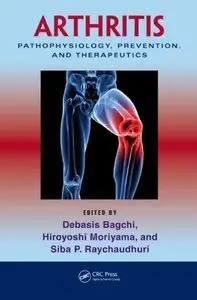 Arthritis: Pathophysiology, Prevention, and Therapeutics (Repost)
