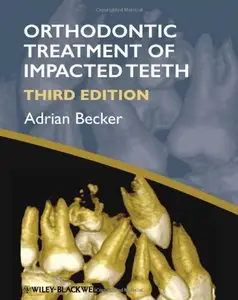 Orthodontic Treatment of Impacted Teeth, 3 edition