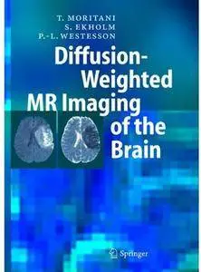 Diffusion-Weighted MR Imaging of the Brain