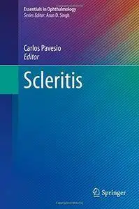 Scleritis (Essentials in Ophthalmology) [Repost]