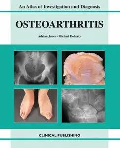 Oesteoarthritis: An Atlas of Investigation and Diagnosis (repost)