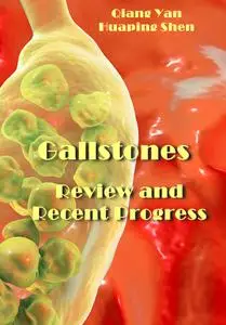 "Gallstones: Review and Recent Progress" ed. by Qiang Yan, Huaping Shen