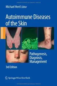 Autoimmune Diseases of the Skin: Pathogenesis, Diagnosis, Management