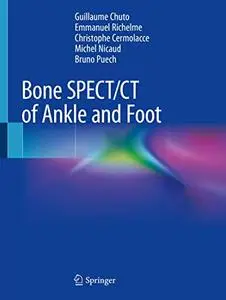 Bone SPECT/CT of Ankle and Foot (Repost)