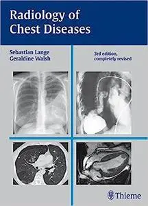 Radiology of Chest Diseases (Repost)