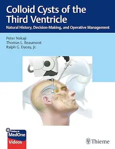 Colloid Cysts of the Third Ventricle