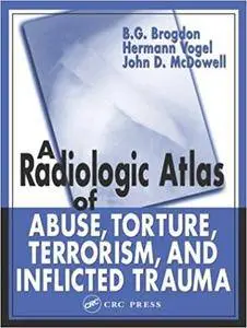 A Radiologic Atlas of Abuse, Torture, Terrorism, and Inflicted Trauma (Repost)