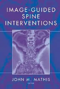 Image-Guided Spine Interventions