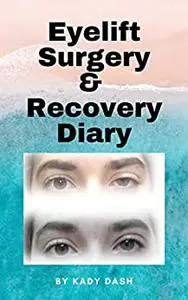 Eyelift Surgery and Recovery Diary: Ptosis, eyelifts, punctal plugs, and dry eyes