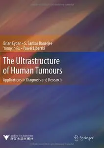 The Ultrastructure of Human Tumours: Applications in Diagnosis and Research
