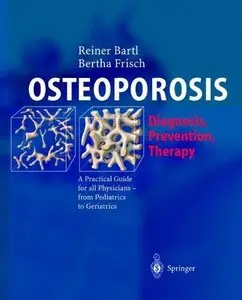 OSTEOPOROSIS: Diagnosis, Prevention, Therapy (Repost)