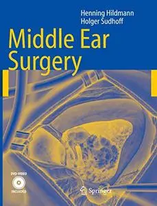 Middle Ear Surgery (Repost)