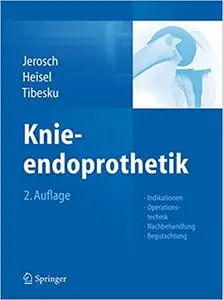 Knieendoprothetik: Indikationen, Operationstechnik, Nachbehandlung, Begutachtung