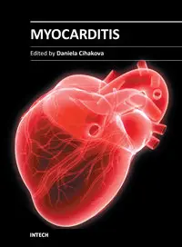 Myocarditis by Daniela Cihakova