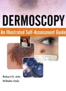 Dermoscopy: An Illustrated Self-Assessment Guide (repost)