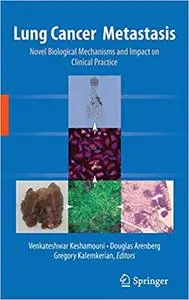 Lung Cancer Metastasis: Novel Biological Mechanisms and Impact on Clinical Practice (Repost)