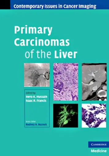 Primary Carcinomas of the Liver (Contemporary Issues in Cancer Imaging) (repost)