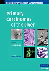 Primary Carcinomas of the Liver (Contemporary Issues in Cancer Imaging) (repost)