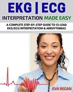 EKG: EKG Interpretation Made Easy: A Complete Step-By-Step Guide to 12-Lead EKG/ECG Interpretation & Arrhythmias