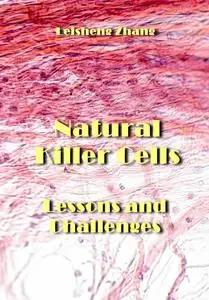 "Natural Killer Cells: Lessons and Challenges" ed. by Leisheng Zhang