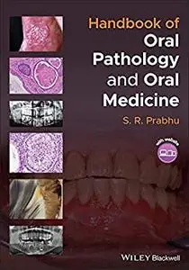 Handbook of Oral Pathology and Oral Medicine