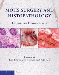 Histopathology on Mohs surgery