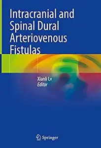 Intracranial and Spinal Dural Arteriovenous Fistulas