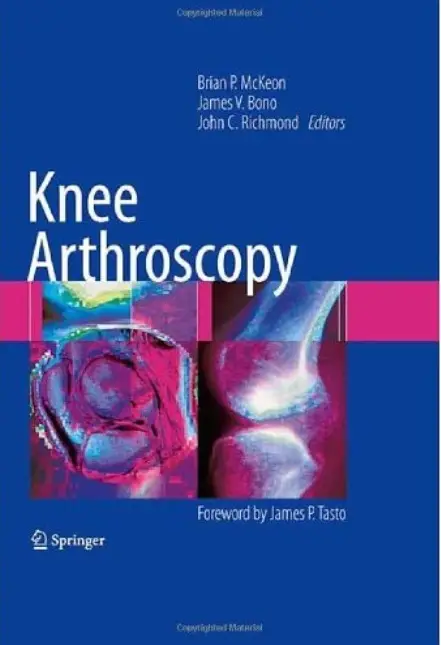 Knee Arthroscopy