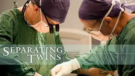 NOVA S39E14 "Separating Twins"