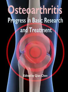 "Osteoarthritis: Progress in Basic Research and Treatment" ed. by Qian Chen