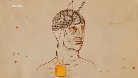(Arte) Stimulation cérébrale, un nouvel espoir pour les T.O.C. (2012)
