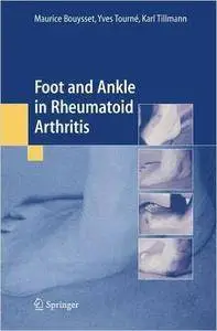 Foot and ankle in rheumatoid arthritis