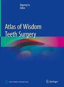 Atlas of Wisdom Teeth Surgery (Repost)