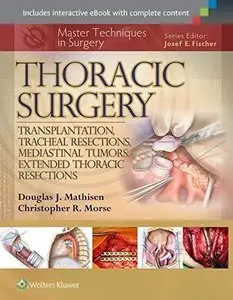  Thoracic Surgery: Transplantation, Tracheal Resections, Mediastinal Tumors, Extended Thoracic Resections (Repost)