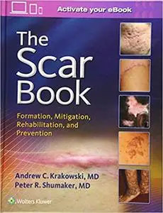 The Scar Book: Formation, Mitigation, Rehabilitation and Prevention (Repost)