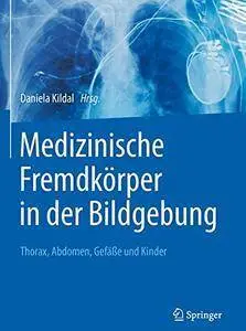 Medizinische Fremdkörper in der Bildgebung: Thorax, Abdomen, Gefäße und Kinder (repost)