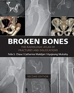 Broken Bones: The Radiologic Atlas of Fractures and Dislocations (Repost)