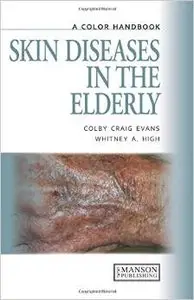 Skin Diseases in the Elderly: A Color Handbook