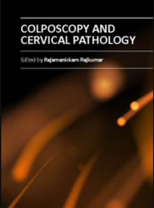 Colposcopy and Cervical Pathology