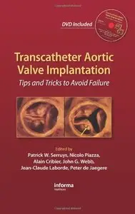 Transcatheter Aortic Valve Implantation: Tips and Tricks to Avoid Failure (Repost)