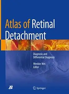Atlas of Retinal Detachment: Diagnosis and Differential Diagnosis (Repost)