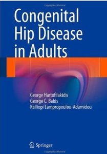 Congenital Hip Disease in Adults [Repost]