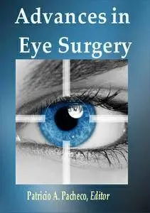 "Advances in Eye Surgery" ed. by Patricio A. Pacheco