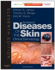 Andrews' Diseases of the Skin: Clinical Dermatology, 11th Edition (repost)