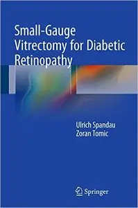 Small-Gauge Vitrectomy for Diabetic Retinopathy (repost)