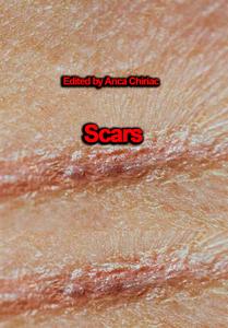 "Scars" ed. by Anca Chiriac